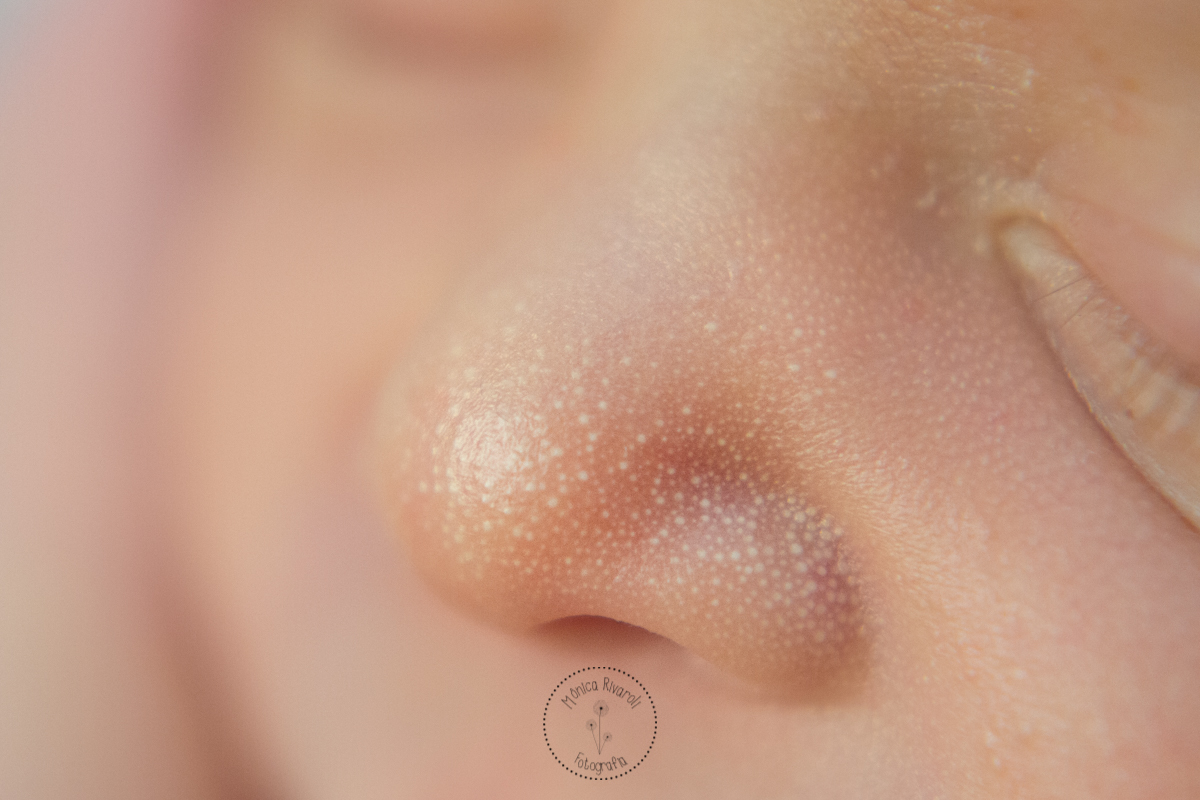 Detalhes do narizinho do Mateus