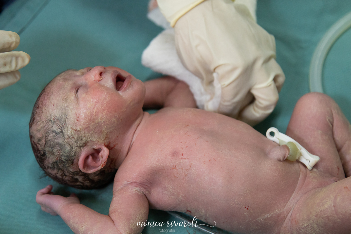 Momento em que a Ana Clara nasce! Fotografo de parto Mônica Rivaroli fotografia em Maringá. Tentantes, infertilidade, trombofilia endometriose.  Já foi cortado o cordão umbilical. Parto de gêmeos, gestação gemelar. 
