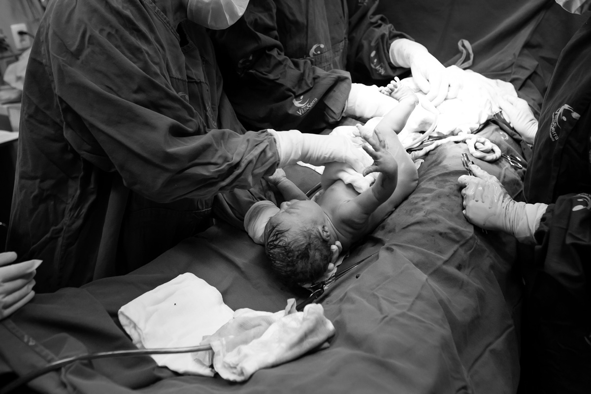 bebê recebendo a limpeza na barriga pelos médicos