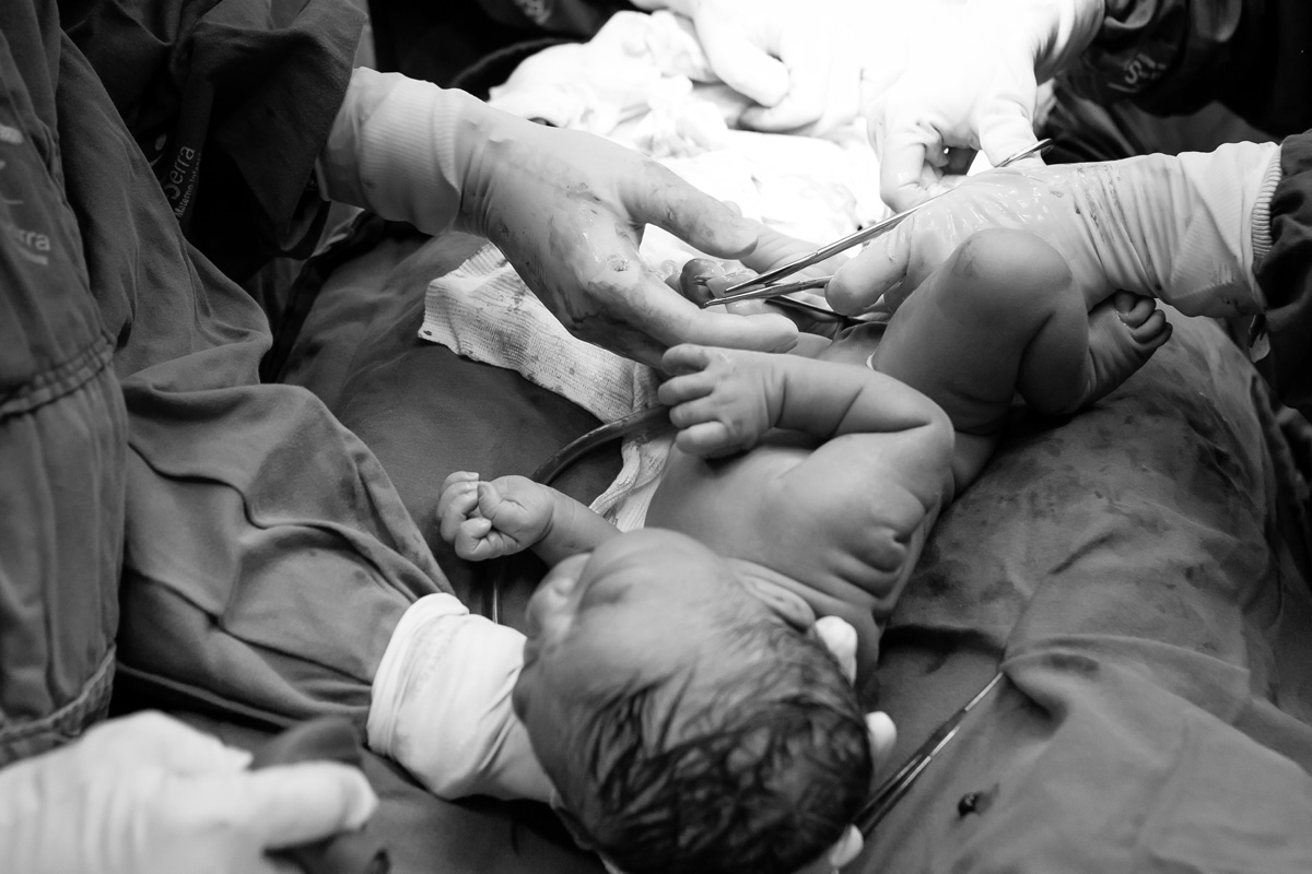bebê e o médico cortando o cordão umbilical