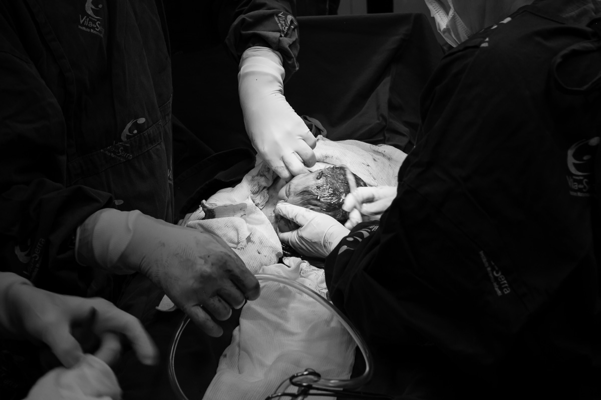 cabeça do bebê aparecendo