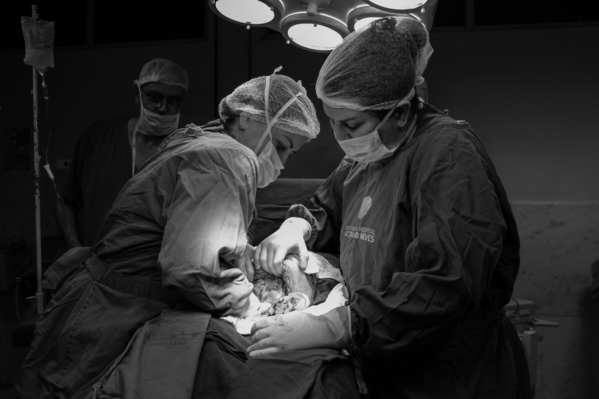 médicos retirando o bebê