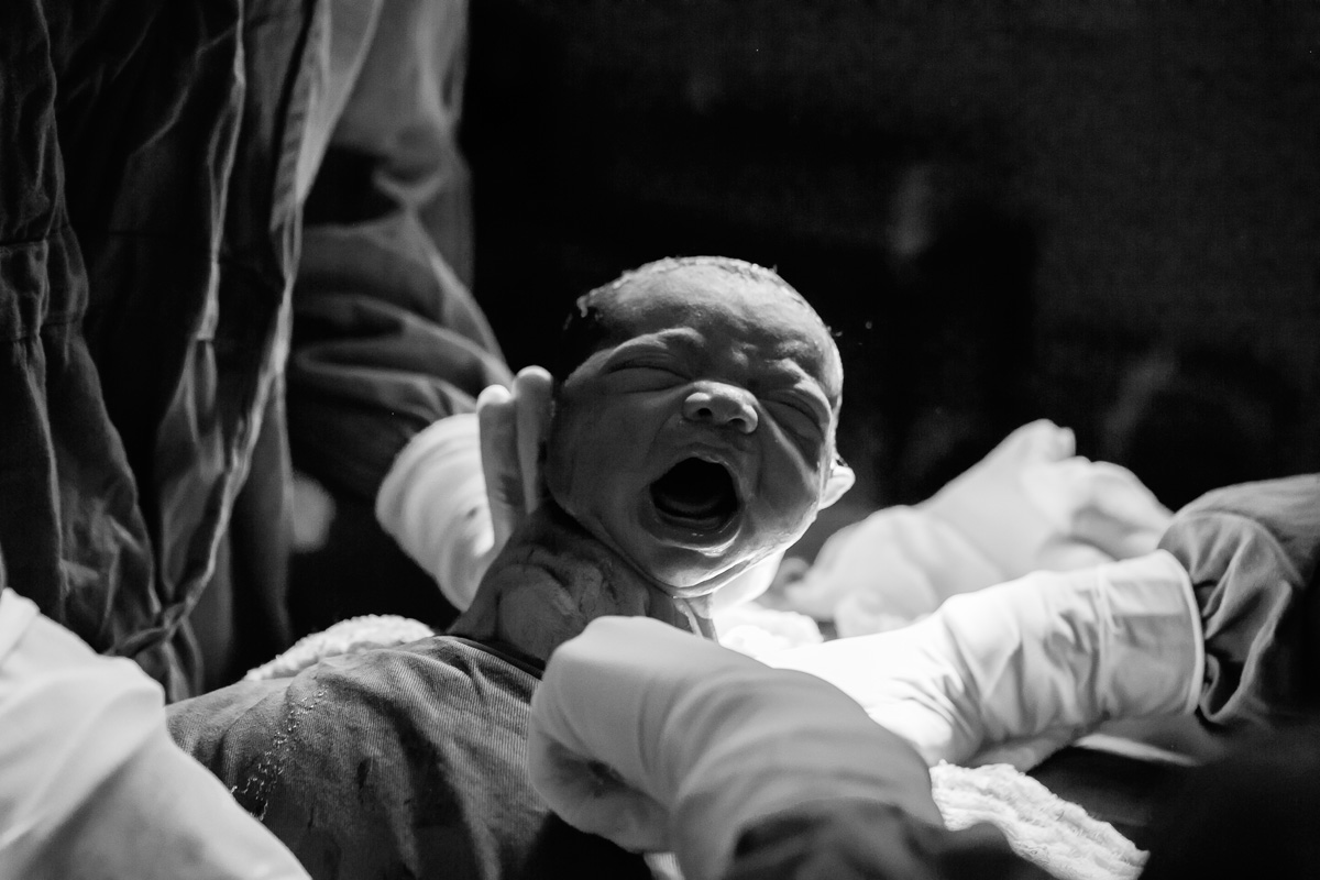 bebê nascendo