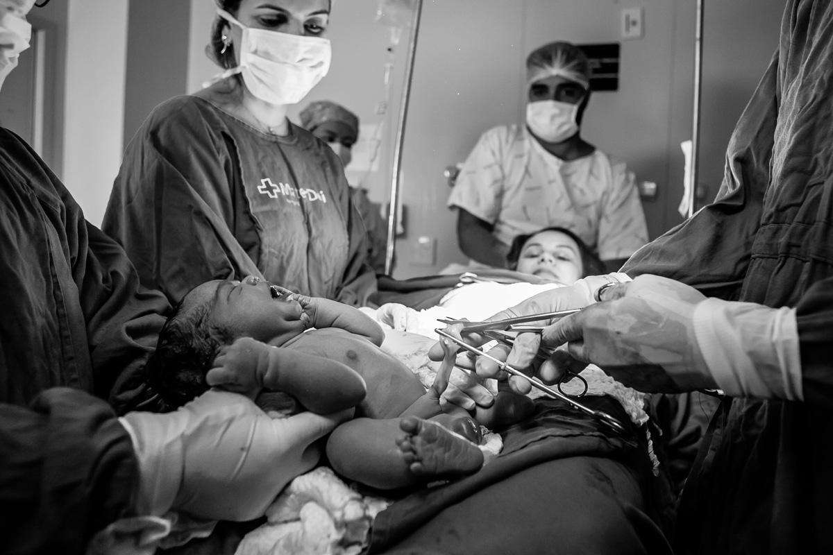 médico cortando o cordão umbilical