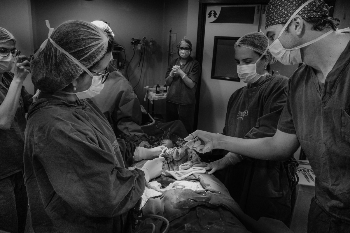 cortando o cordão umbilical