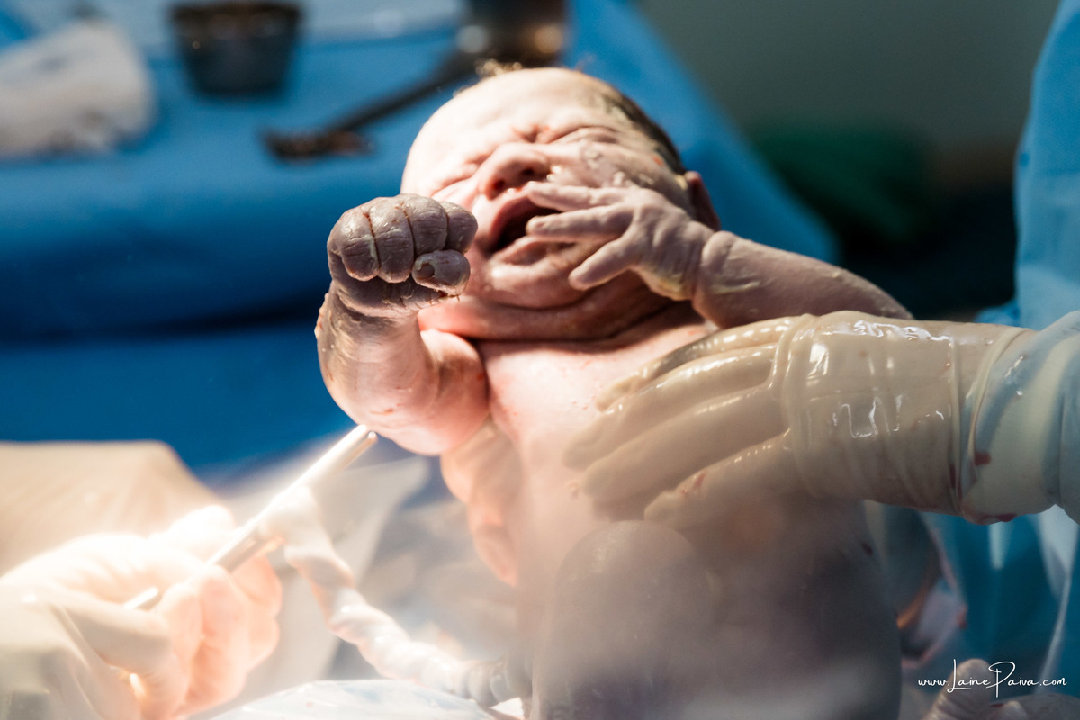fotografia de parto - hospital rio grande - maternidade delfin - natal rn - parto cesaria - fotografo de parto - familia - nascimento - fotografo em natal - fotografo de familia - parto normal - medico - obstetra - parto natural - unimed natal - mae