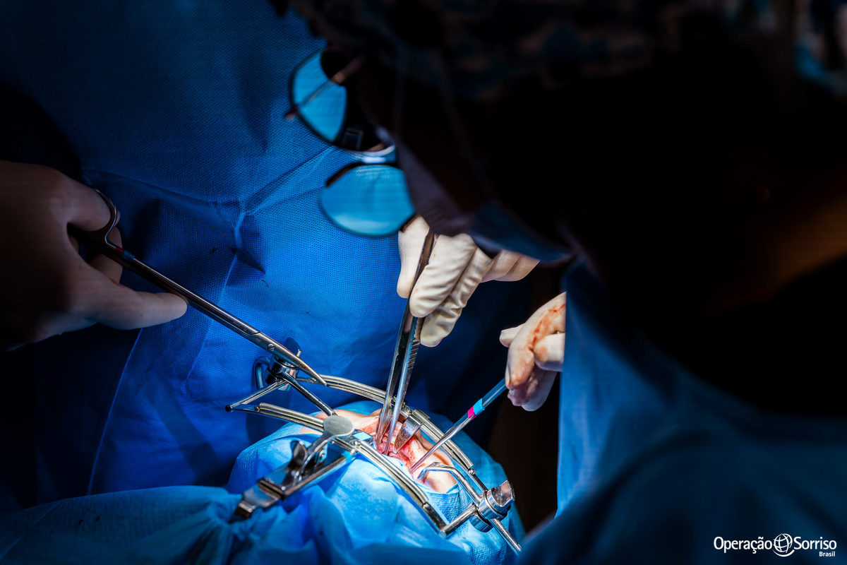 Operação Sorriso Brasil, MIssão Porto Velho, Operation Smile, Azul linhas aereas, Rondônia, Lábio leporino, fenda palatina, Johnson & Johnson, triagem, cirurgias, crianças, 