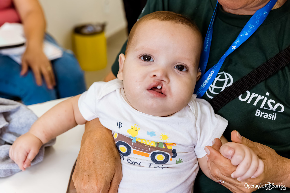 Operação Sorriso Brasil, MIssão Porto Velho, Operation Smile, Azul linhas aereas, Rondônia, Lábio leporino, fenda palatina, Johnson & Johnson, triagem, cirurgias, crianças, 