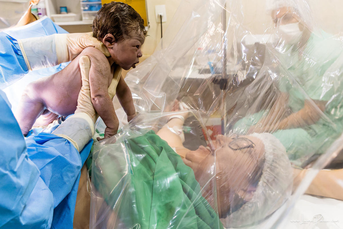fotografia de parto - hospital unimed - maternidade - natal rn - parto cesaria - fotografo de parto - familia - nascimento - fotografo em natal - fotografo de familia - parto normal - medico - obstetra - parto natural - hospital riogrande - hospital do co