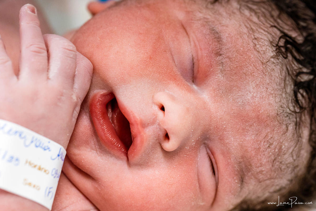 fotografia de parto na maternidade do hospital da Unimed,  parto cesaria, mãe de primeira viagem de menina, primeiros momentos de vida com amor e cuidado, fotografo de parto e familia em Natal, cobertura completa da cesariana