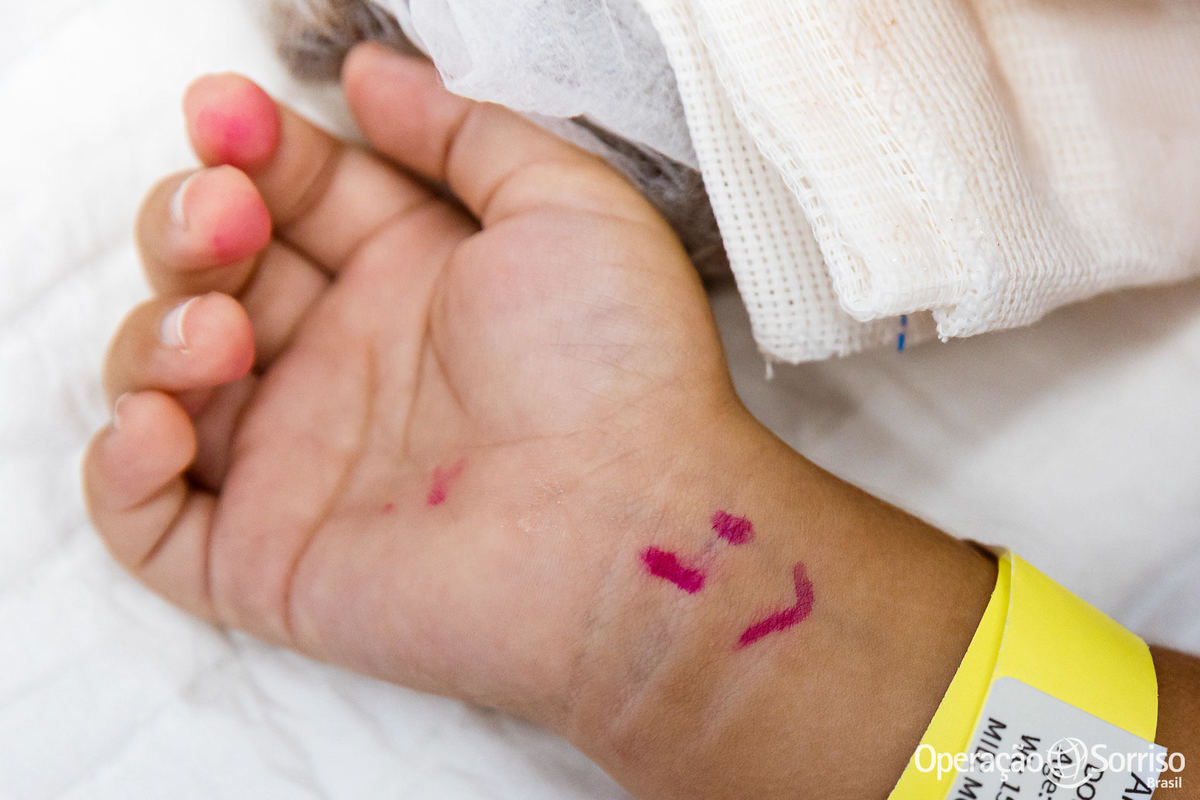 Operação Sorriso Brasil, Women in Medice,  MIssão Mossoró, Operation Smile, Azul linhas aereas, Hospital da Mulher,  Lábio leporino, fenda palatina, triagem, cirurgias, crianças, medicos, volutários, trabalho voluntário