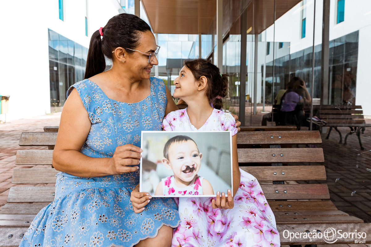 Operação Sorriso Brasil, Women in Medice,  MIssão Mossoró, Operation Smile, Azul linhas aereas, Hospital da Mulher,  Lábio leporino, fenda palatina, triagem, cirurgias, crianças, medicos, volutários, trabalho voluntário