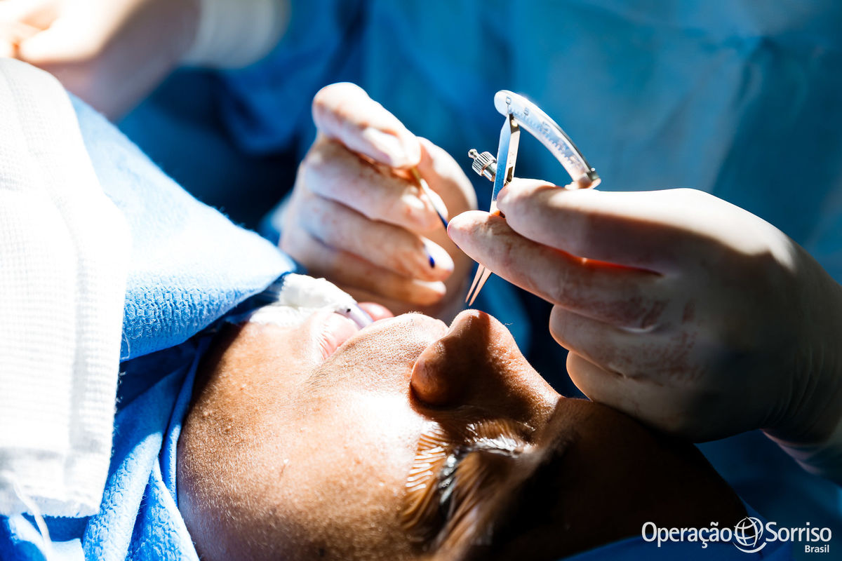 Operação Sorriso Brasil, Women in Medice,  MIssão Mossoró, Operation Smile, Azul linhas aereas, Hospital da Mulher,  Lábio leporino, fenda palatina, triagem, cirurgias, crianças, medicos, volutários, trabalho voluntário