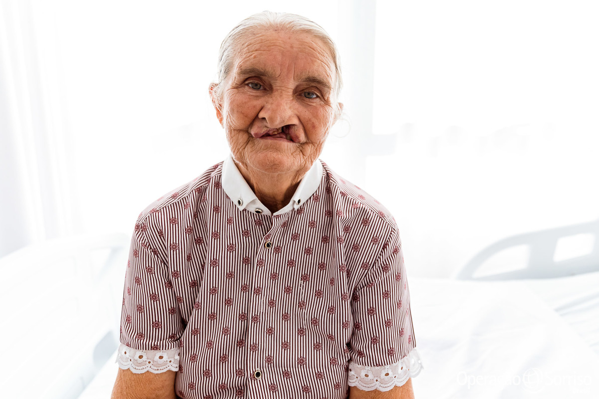 Operação Sorriso Brasil, Women in Medice,  MIssão Mossoró, Operation Smile, Azul linhas aereas, Hospital da Mulher,  Lábio leporino, fenda palatina, triagem, cirurgias, crianças, medicos, volutários, trabalho voluntário