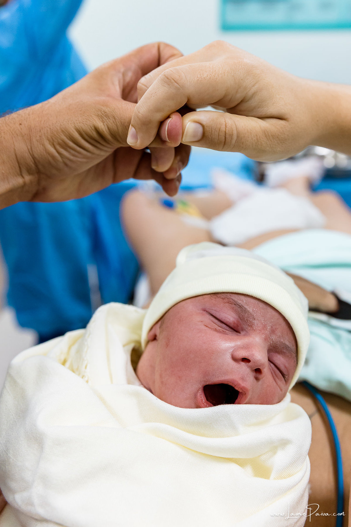 fotografia de parto na maternidade do hospital do coração,  parto cesaria, mãe de primeira viagem de menino, primeiros momentos de vida com amor e cuidado, fotografo de parto e familia em Natal, cobertura completa da cesariana