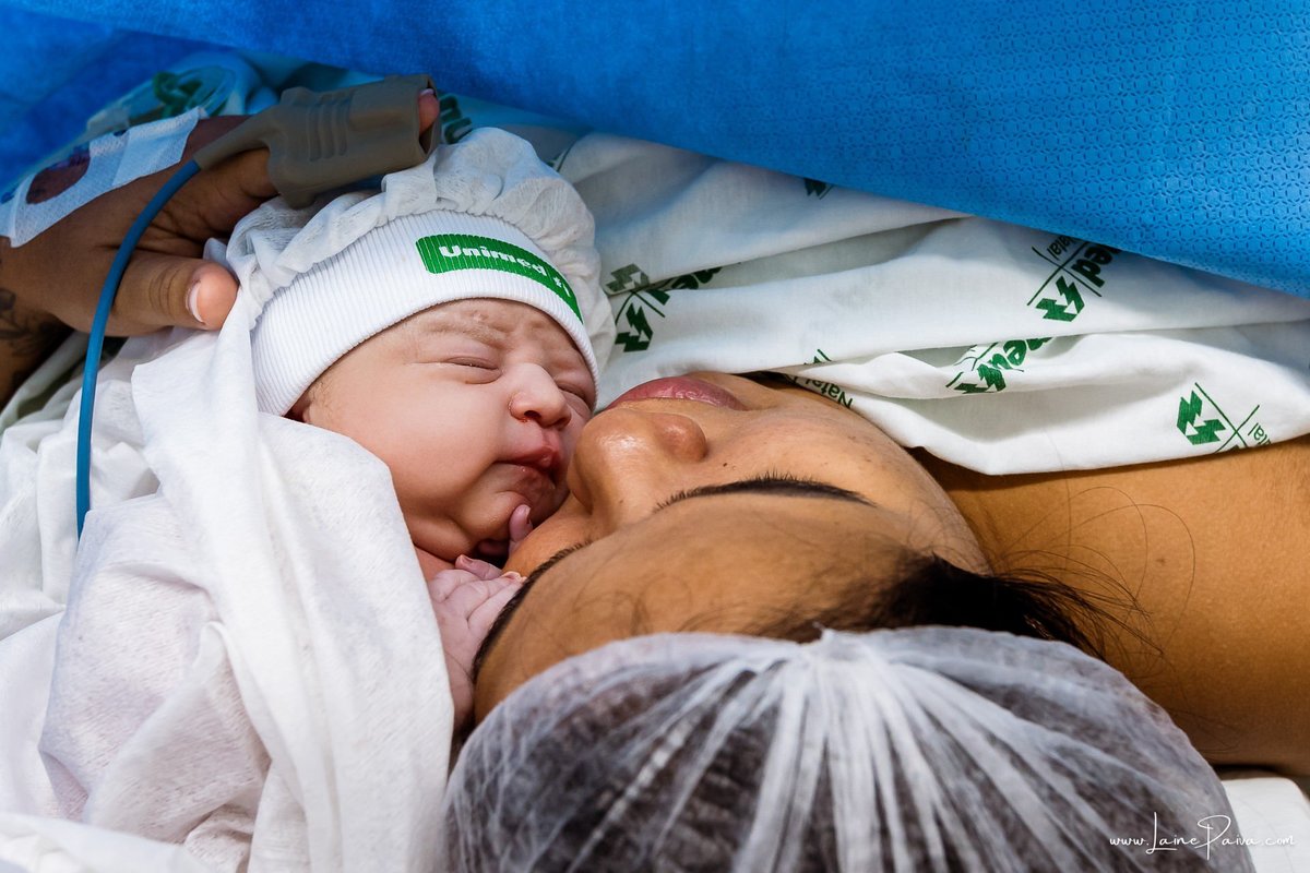 fotografia de parto na maternidade do hospital da Unimed,  parto cesaria, mãe de primeira viagem de menina, primeiros momentos de vida com amor e cuidado, fotografo de parto e familia em Natal, cobertura completa da cesariana