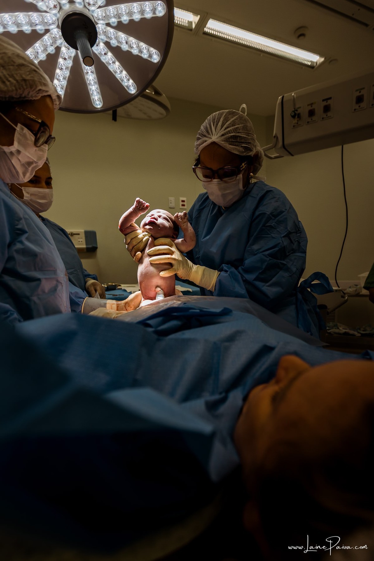 fotografia de parto na maternidade do hospital da Unimed,  parto cesaria, mãe de segunda viagem de menina, primeiros momentos de vida com amor e cuidado, fotografo de parto e familia em Natal, cobertura completa da cesariana, dra luane barros,