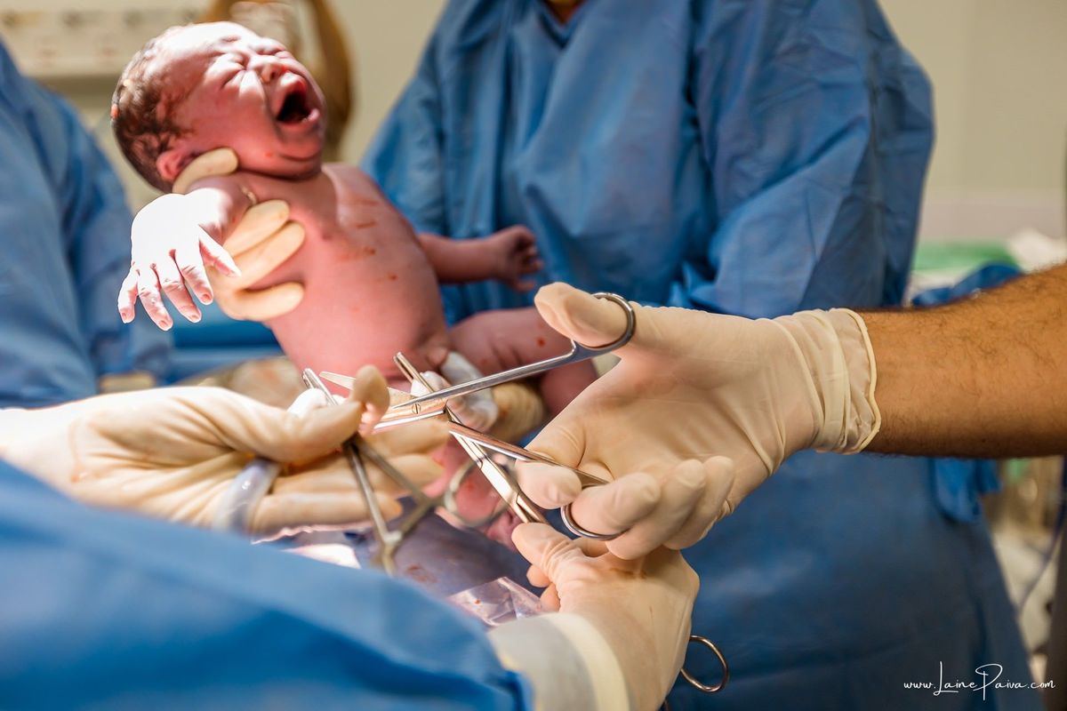 fotografia de parto na maternidade do hospital da Unimed,  parto cesaria, mãe de segunda viagem de menina, primeiros momentos de vida com amor e cuidado, fotografo de parto e familia em Natal, cobertura completa da cesariana, dra luane barros,