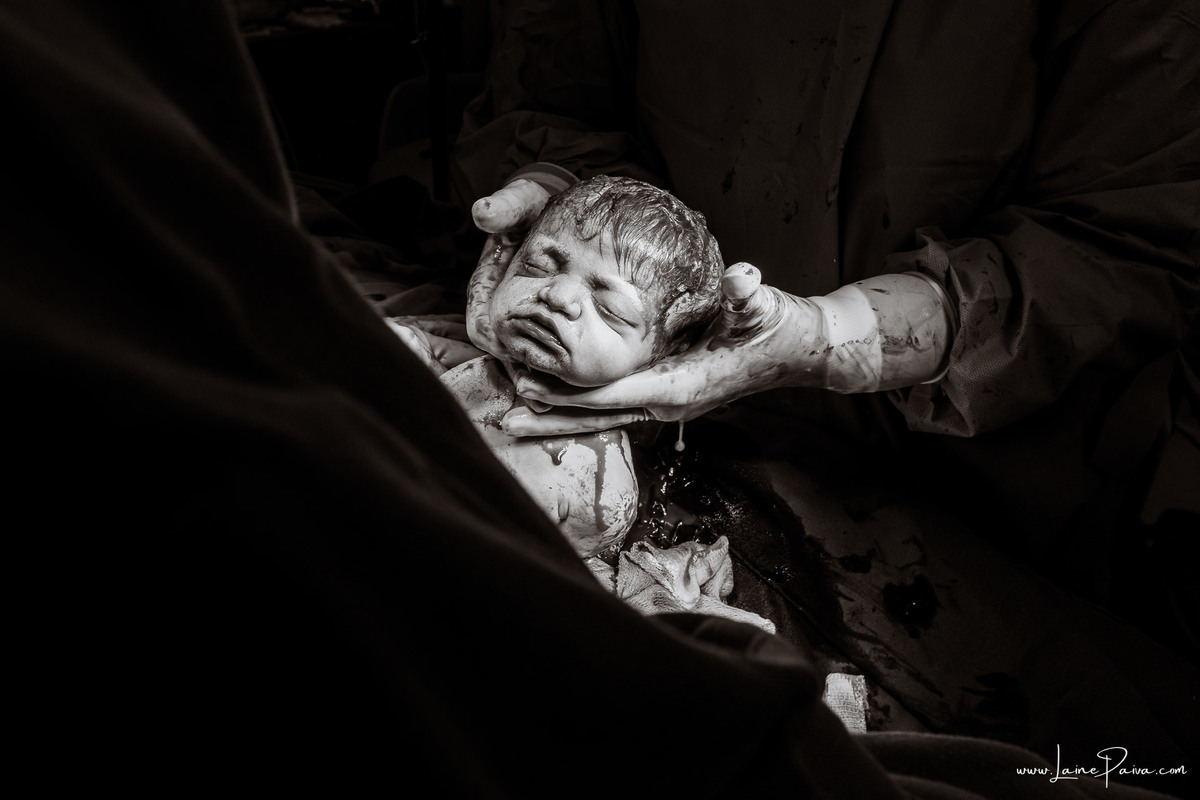 fotografia de parto na maternidade do hospital rio grande, maternidade Delphin,  parto cesaria, mãe de pimeira viagem de menina, primeiros momentos de vida com amor e cuidado, fotografo de parto e familia em Natal, cobertura completa da cesariana,