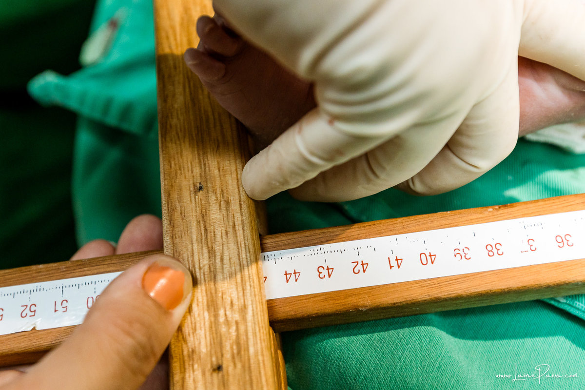fotografia de parto na maternidade do hospital rio grande, maternidade Delphin,  parto cesaria, mãe de pimeira viagem de menina, primeiros momentos de vida com amor e cuidado, fotografo de parto e familia em Natal, cobertura completa da cesariana,