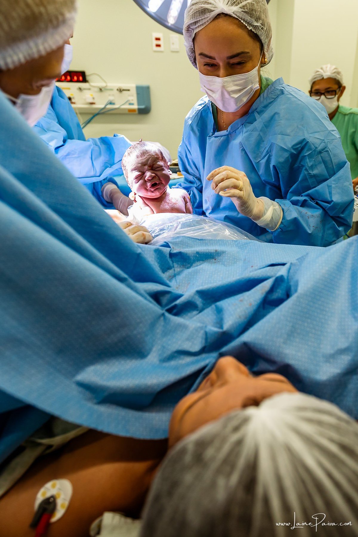 fotografia de parto na maternidade do hospital da Unimed,  parto cesaria, mãe de primeira viagem de menino, primeiros momentos de vida com amor e cuidado, fotografo de parto e familia em Natal, cobertura completa da cesariana, dra priscylla carolinne,