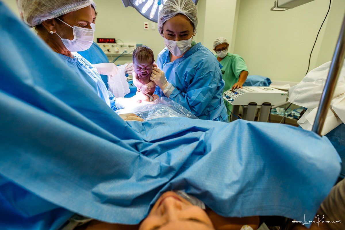 fotografia de parto na maternidade do hospital da Unimed,  parto cesaria, mãe de primeira viagem de menino, primeiros momentos de vida com amor e cuidado, fotografo de parto e familia em Natal, cobertura completa da cesariana, dra priscylla carolinne,