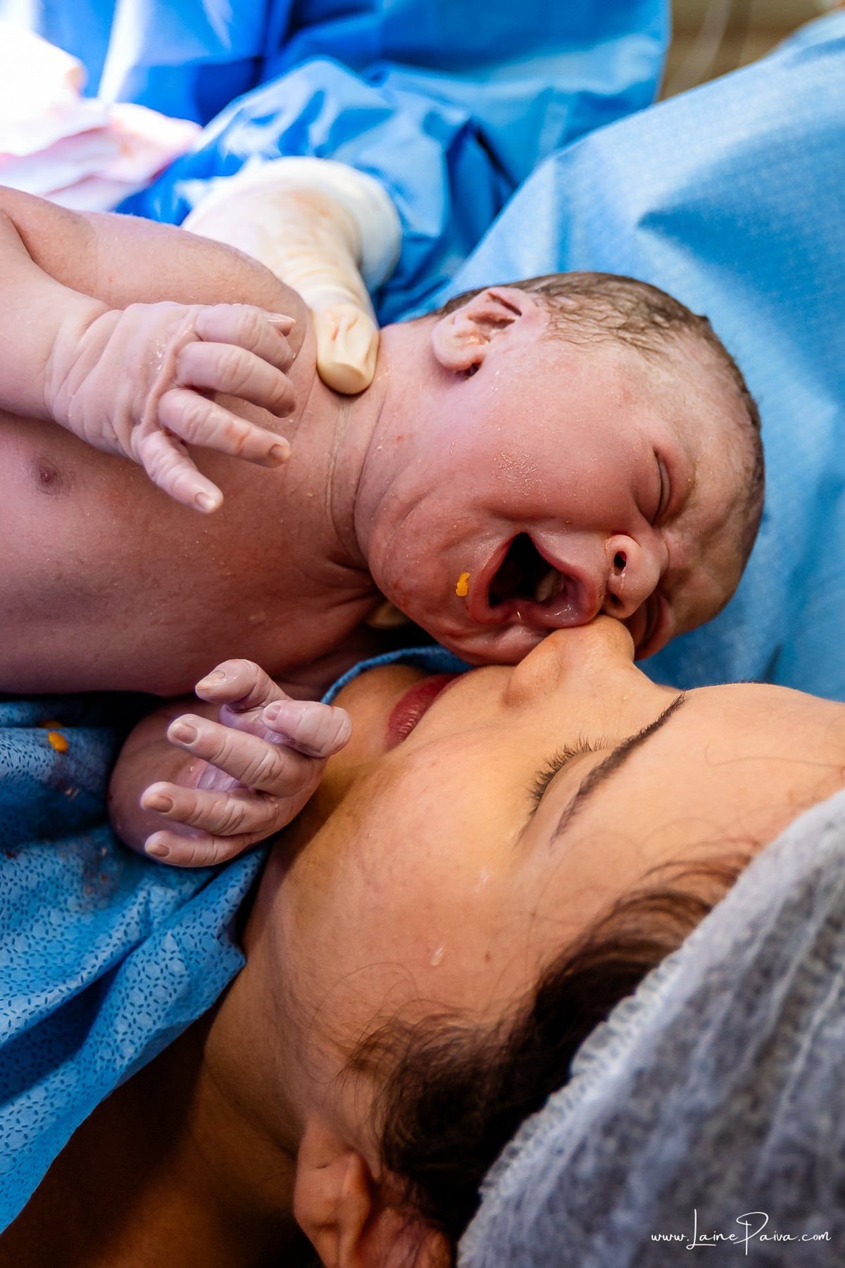 fotografia de parto na maternidade do hospital da Unimed,  parto cesaria, mãe de primeira viagem de menino, primeiros momentos de vida com amor e cuidado, fotografo de parto e familia em Natal, cobertura completa da cesariana, dra priscylla carolinne,