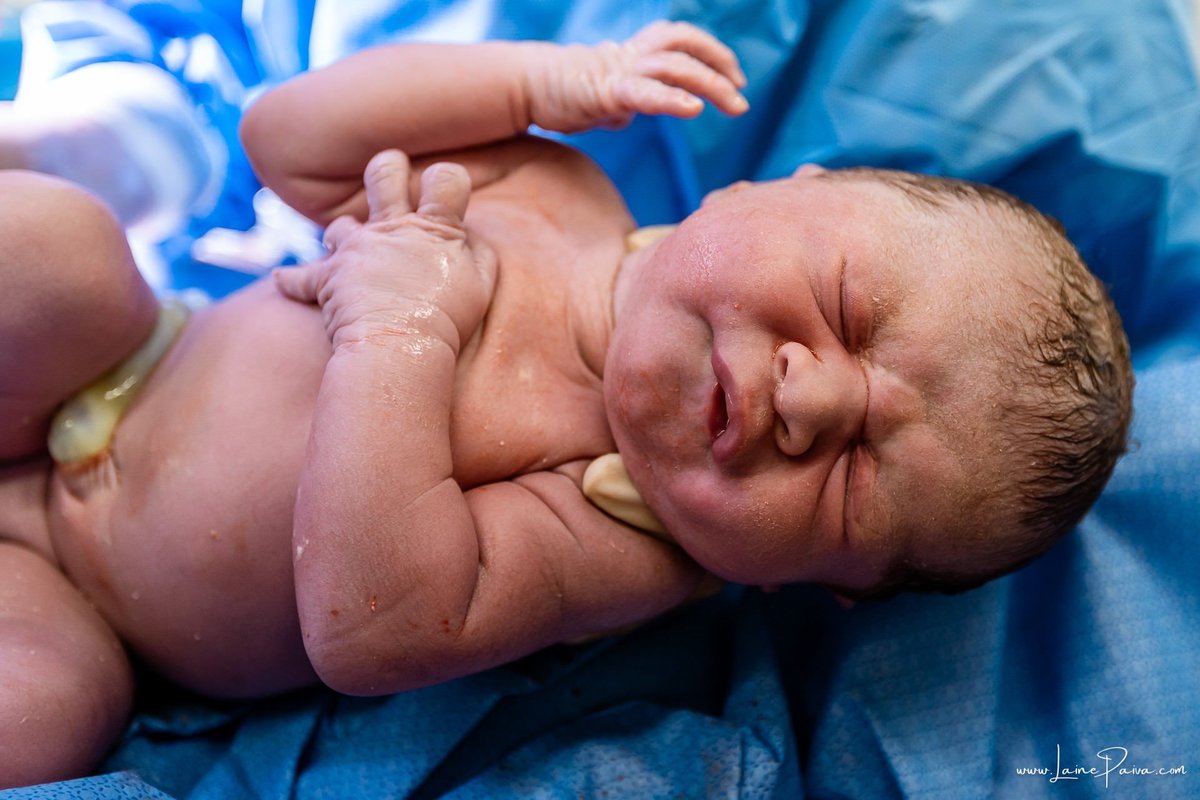 fotografia de parto na maternidade do hospital da Unimed,  parto cesaria, mãe de primeira viagem de menino, primeiros momentos de vida com amor e cuidado, fotografo de parto e familia em Natal, cobertura completa da cesariana, dra priscylla carolinne,