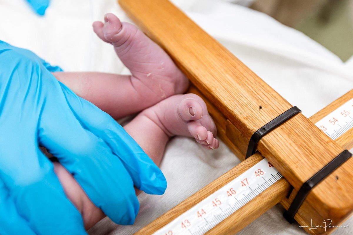 fotografia de parto na maternidade do hospital da Unimed,  parto cesaria, mãe de primeira viagem de menino, primeiros momentos de vida com amor e cuidado, fotografo de parto e familia em Natal, cobertura completa da cesariana, dra priscylla carolinne,