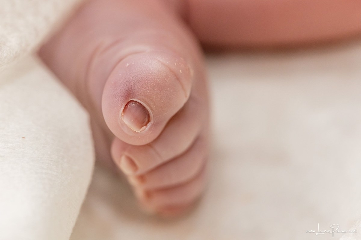 fotografia de parto na maternidade do hospital da Unimed,  parto cesaria, mãe de primeira viagem de menino, primeiros momentos de vida com amor e cuidado, fotografo de parto e familia em Natal, cobertura completa da cesariana, dra priscylla carolinne,