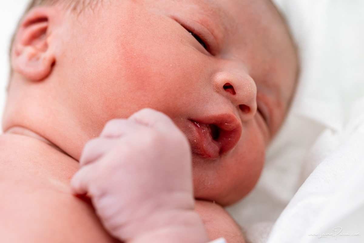 fotografia de parto na maternidade do hospital da Unimed,  parto cesaria, mãe de primeira viagem de menino, primeiros momentos de vida com amor e cuidado, fotografo de parto e familia em Natal, cobertura completa da cesariana, dra priscylla carolinne,