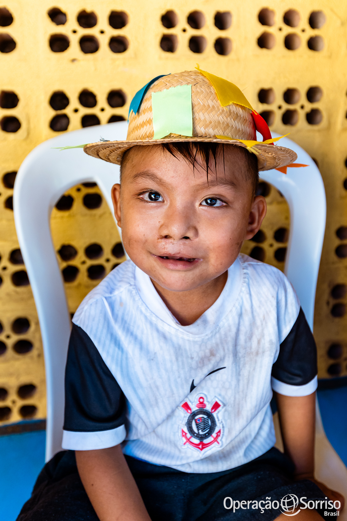 Operação Sorriso Brasil, MIssão Santarém, Pará, Operation Smile, Azul linhas aéreas, Hospital Regional do Baixo Amazonas,  Lábio leporino, fenda palatina, cirurgias, crianças, medicos, voluntários, trabalho voluntário, voluntariado, fissura lábiopalatina