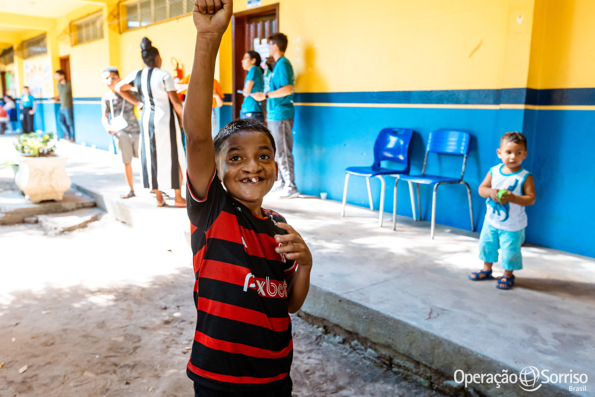 Operação Sorriso Brasil, MIssão Santarém, Pará, Operation Smile, Azul linhas aéreas, Hospital Regional do Baixo Amazonas,  Lábio leporino, fenda palatina, cirurgias, crianças, medicos, voluntários, trabalho voluntário, voluntariado, fissura lábiopalatina