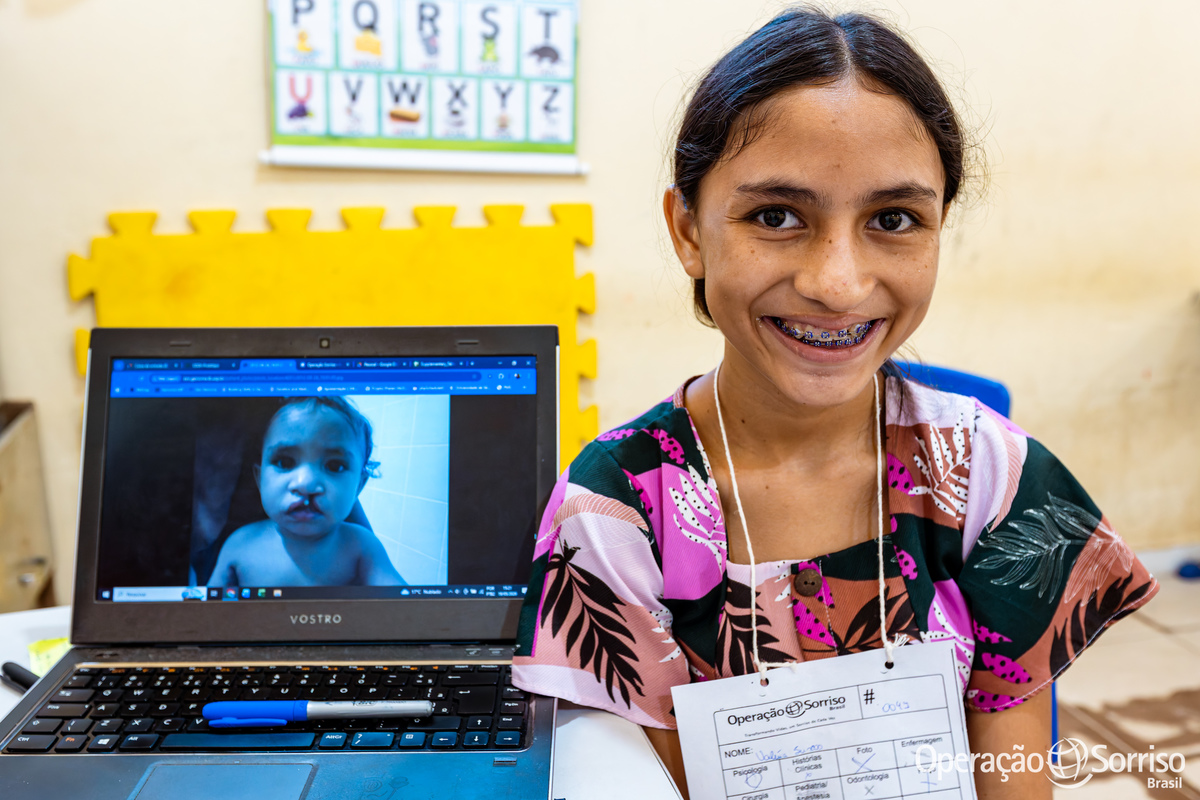 Operação Sorriso Brasil, MIssão Santarém, Pará, Operation Smile, Azul linhas aéreas, Hospital Regional do Baixo Amazonas,  Lábio leporino, fenda palatina, cirurgias, crianças, medicos, voluntários, trabalho voluntário, voluntariado, fissura lábiopalatina
