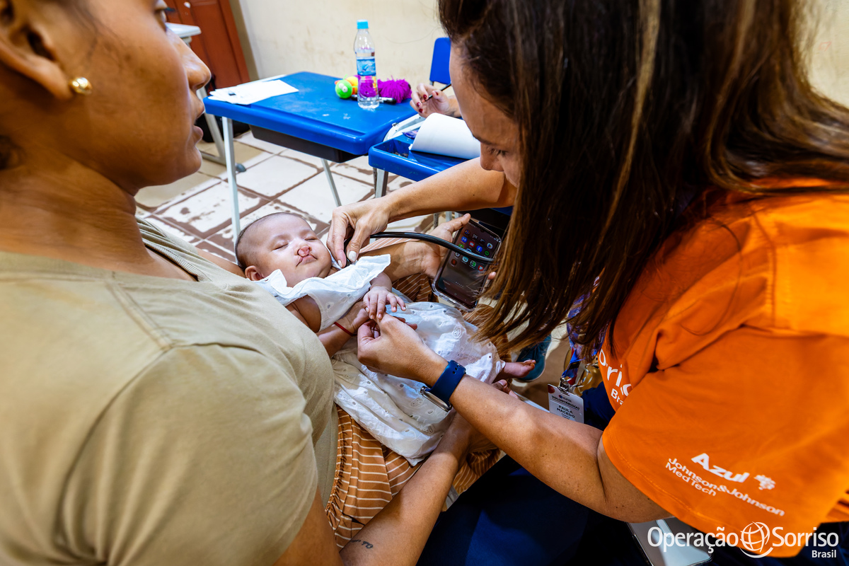 Operação Sorriso Brasil, MIssão Santarém, Pará, Operation Smile, Azul linhas aéreas, Hospital Regional do Baixo Amazonas,  Lábio leporino, fenda palatina, cirurgias, crianças, medicos, voluntários, trabalho voluntário, voluntariado, fissura lábiopalatina