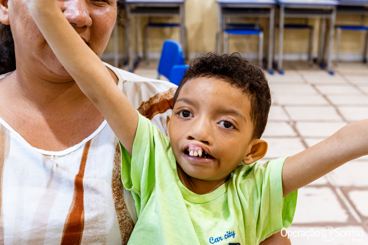 Operação Sorriso Brasil, MIssão Santarém, Pará, Operation Smile, Azul linhas aéreas, Hospital Regional do Baixo Amazonas,  Lábio leporino, fenda palatina, cirurgias, crianças, medicos, voluntários, trabalho voluntário, voluntariado, fissura lábiopalatina