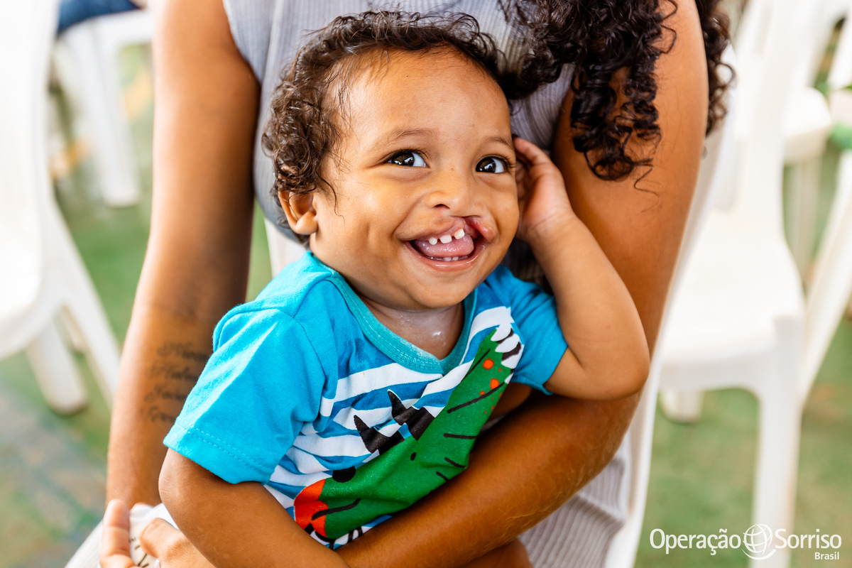Operação Sorriso Brasil, MIssão Santarém, Pará, Operation Smile, Azul linhas aéreas, Hospital Regional do Baixo Amazonas,  Lábio leporino, fenda palatina, cirurgias, crianças, medicos, voluntários, trabalho voluntário, voluntariado, fissura lábiopalatinaO