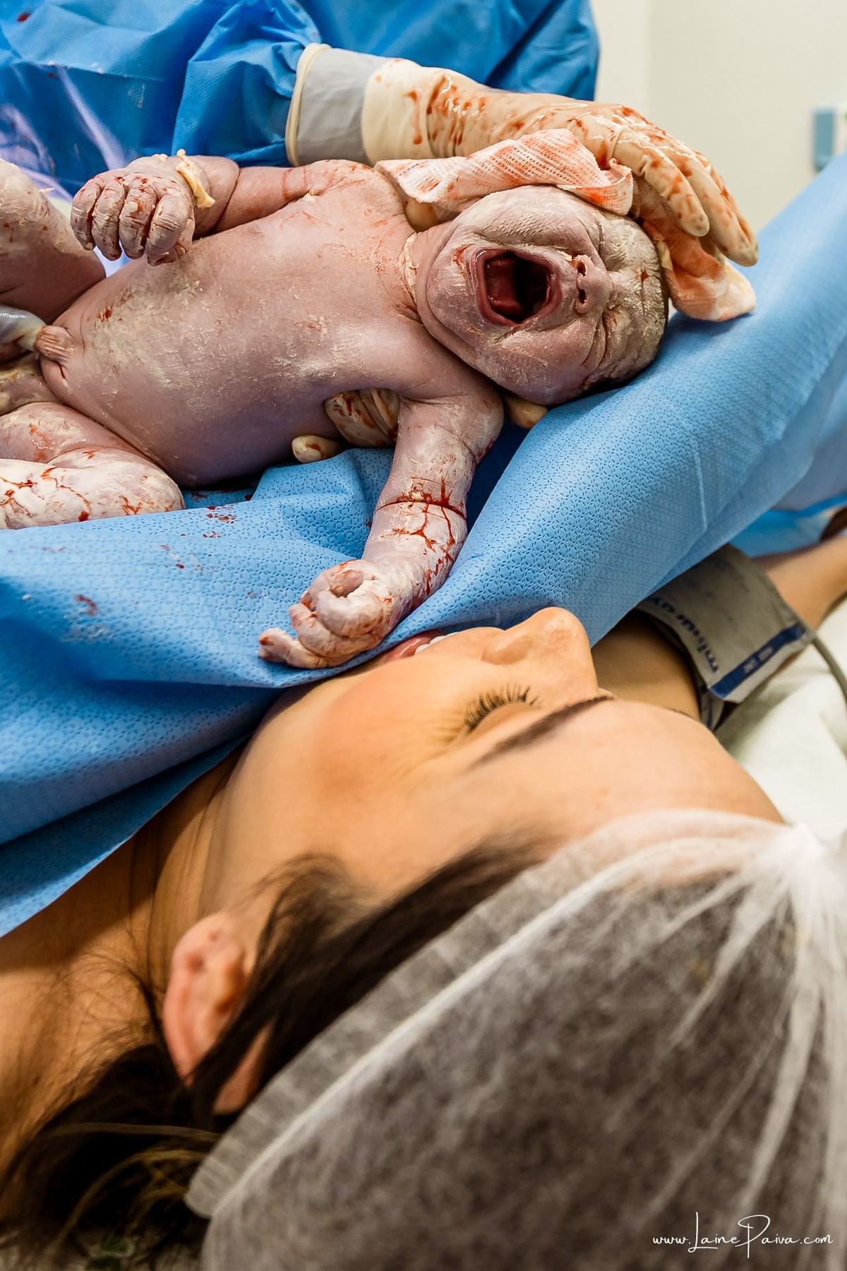 Fotografia de parto no Hospital da Unimed em Natal/RN. Nascimento de Maria Luísa por cesariana. Registro dos primeiros momentos de vida ao lado de Helenna e João. Fotógrafa de parto e família em Natal, cobertura completa do nascimento com olhar documental