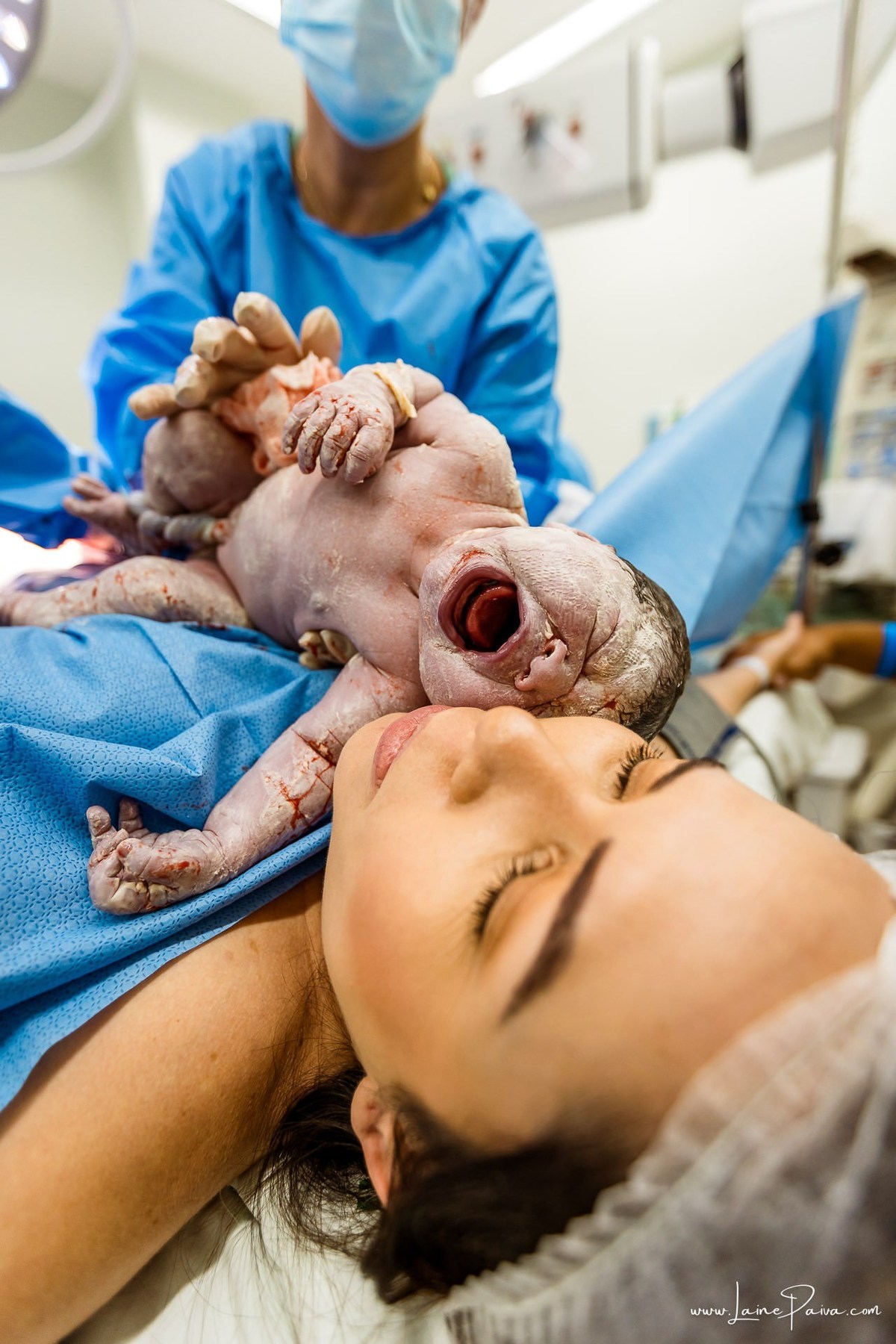 Fotografia de parto no Hospital da Unimed em Natal/RN. Nascimento de Maria Luísa por cesariana. Registro dos primeiros momentos de vida ao lado de Helenna e João. Fotógrafa de parto e família em Natal, cobertura completa do nascimento com olhar documental