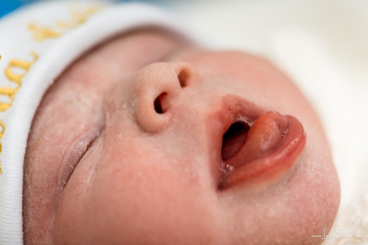 Fotografia de parto no Hospital da Unimed em Natal/RN. Nascimento de Maria Luísa por cesariana. Registro dos primeiros momentos de vida ao lado de Helenna e João. Fotógrafa de parto e família em Natal, cobertura completa do nascimento com olhar documental