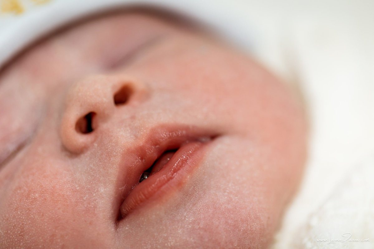 Fotografia de parto no Hospital da Unimed em Natal/RN. Nascimento de Maria Luísa por cesariana. Registro dos primeiros momentos de vida ao lado de Helenna e João. Fotógrafa de parto e família em Natal, cobertura completa do nascimento com olhar documental