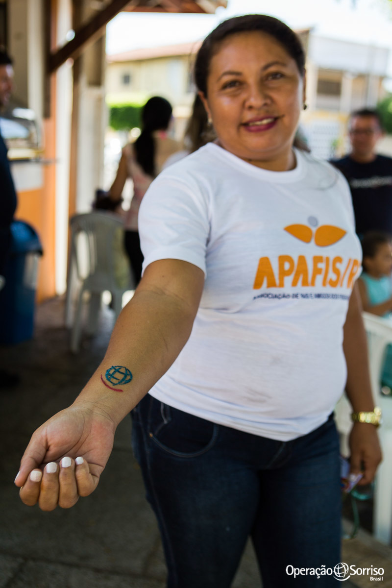 mãe de ex fissurado e voluntaria local da Operação Sorriso mostrando a tatuagem com a logo da ONG.