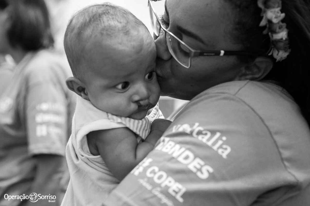 criança recebendo beijo da voluntaria da operação sorriso