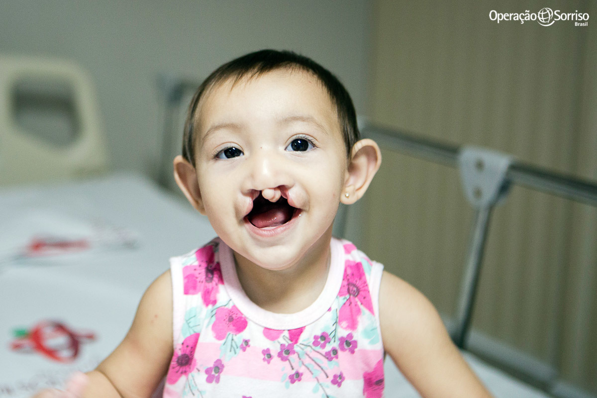 criança fissurada briancando enquanto aguarda cirurgia pela Operação Sorriso