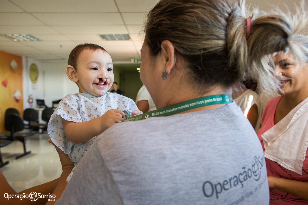 bebe fissurado com voluntaria da operação sorriso