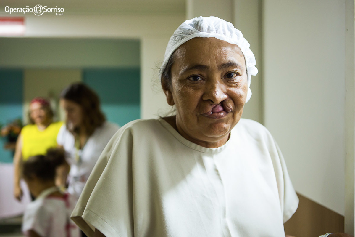 paciente fissurada antes de entrar no centro cirurgico