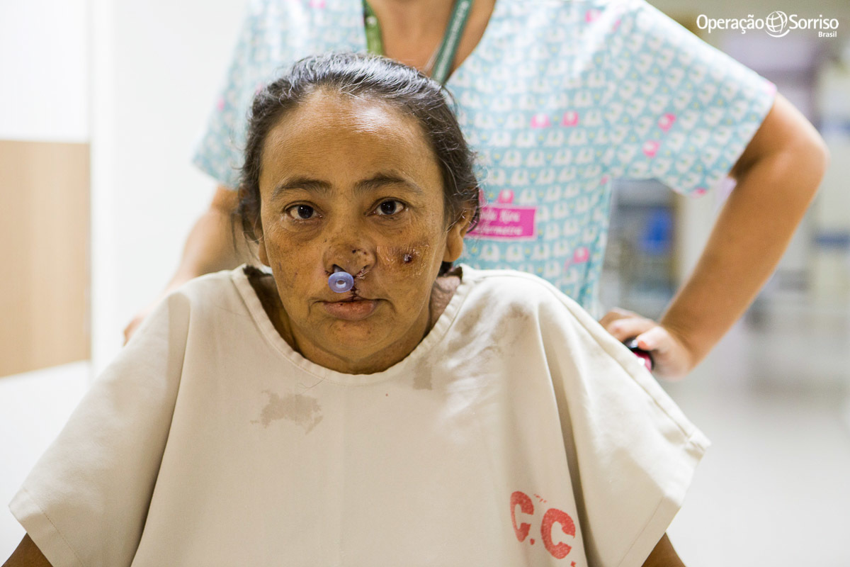 paciente cirurgiada saindo do centro cirurgico