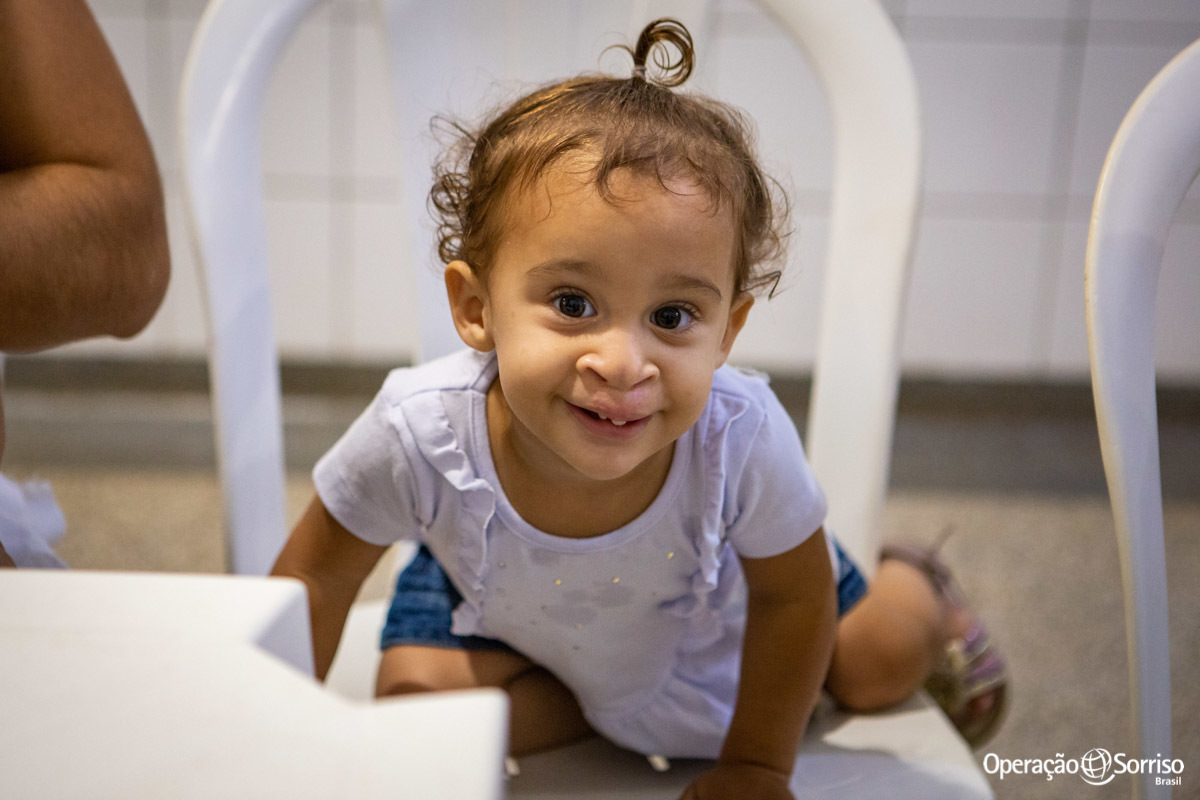 menina com fenda palatal sorrindo