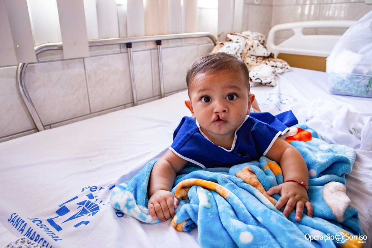 criança fissurada deitada na cama
