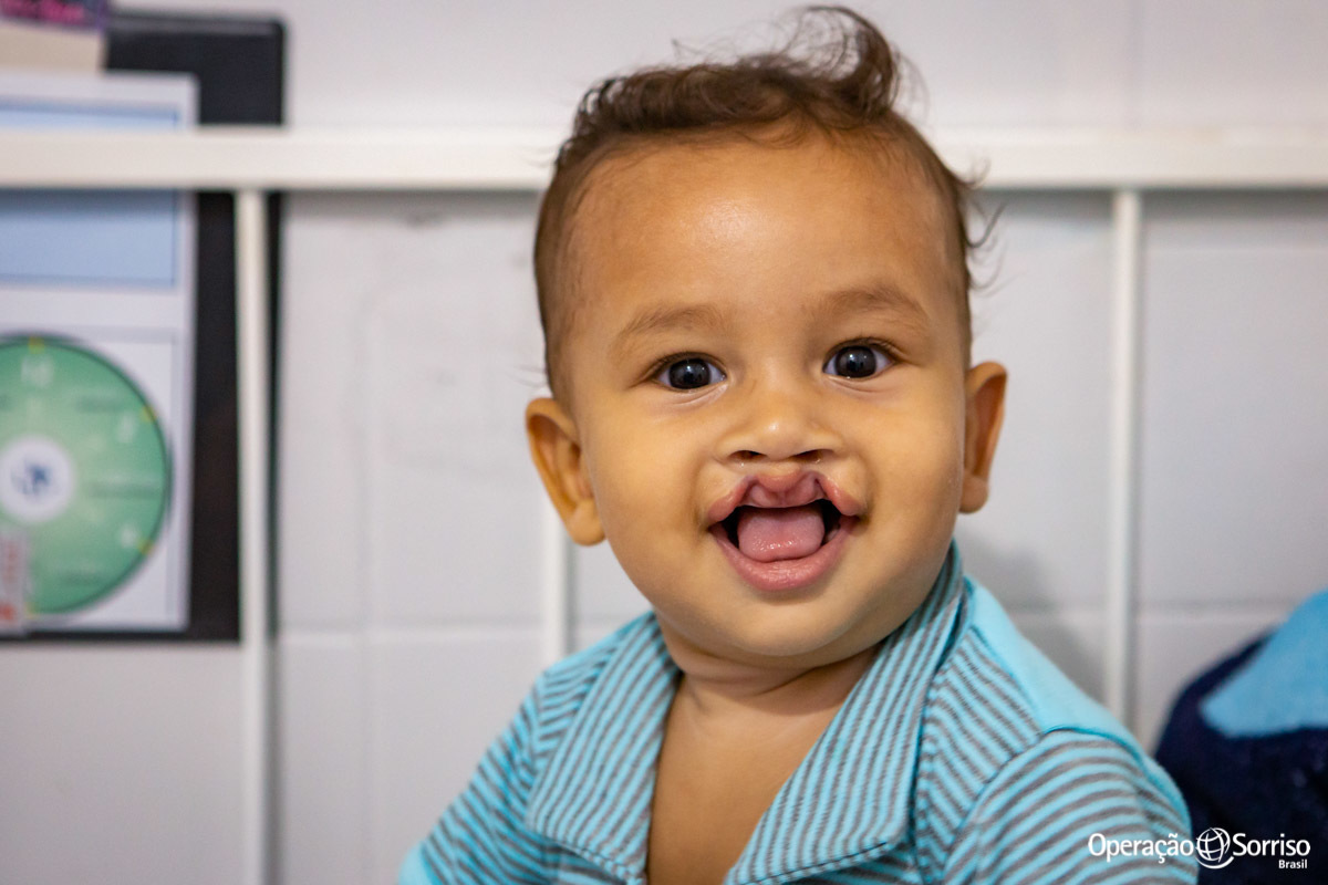criança fissurada sorrindo